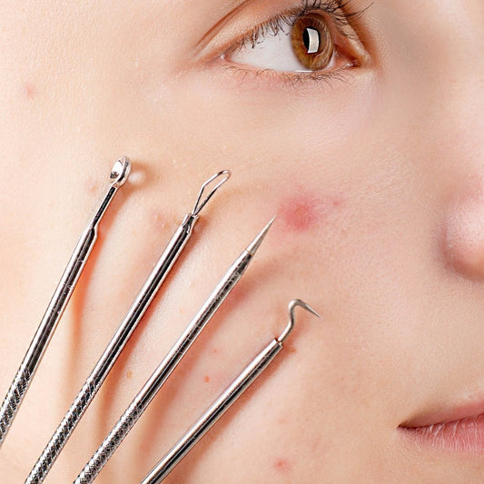 7 Tipos de acné y cómo eliminarlos - Raw Apothecary MX
