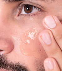 Raw Apothecary MX Aceite facial para piel grasa o con acné - Fix It